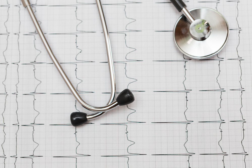 What Is an ECG and Why Might You Need One?